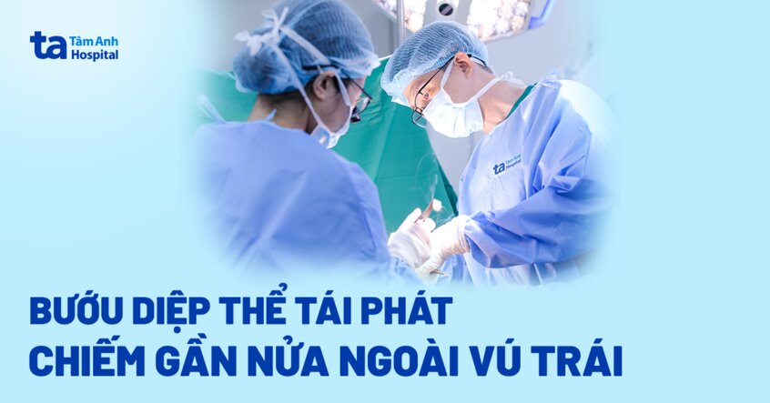 Bướu diệp thể tái phát chiếm gần nửa ngoài vú trái