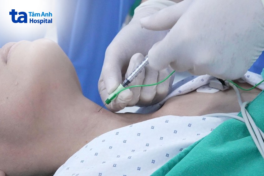 ca tiêm botulinum toxin