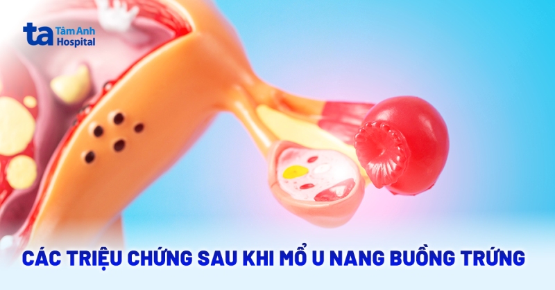 Các triệu chứng sau khi mổ u nang buồng trứng​ và ảnh hưởng hậu phẫu