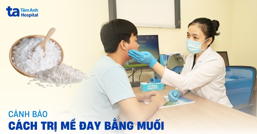 Cảnh báo cách trị mề đay bằng muối tiềm ẩn rủi ro