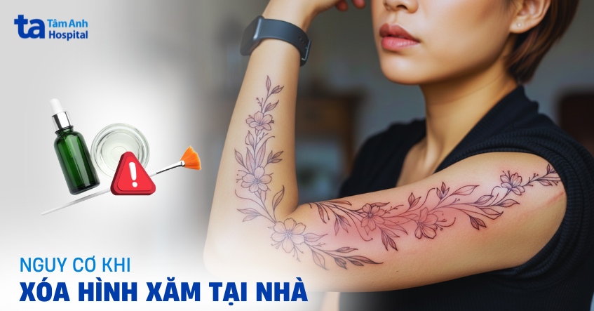 Cảnh báo cách xóa hình xăm tại nhà tiềm tàng nguy hiểm, rủi ro