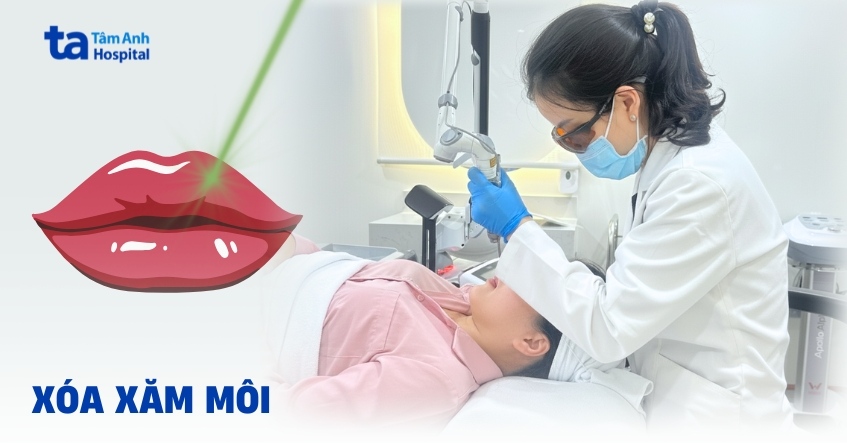 Những cách xóa xăm môi an toàn và nguyên lý cần biết rõ