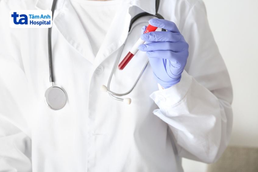 chẩn đoán suy giáp sau điều trị bằng iod phóng xạ