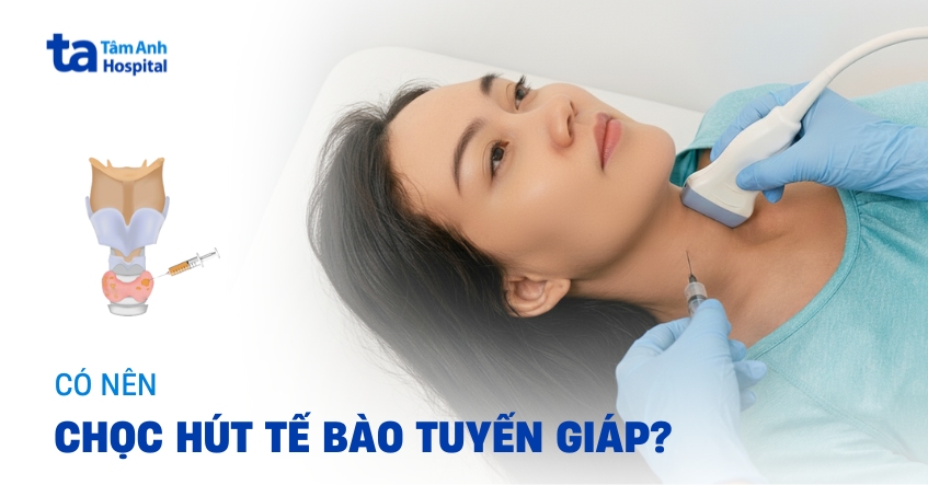 Có nên chọc hút tế bào tuyến giáp không? Có gây đau không?
