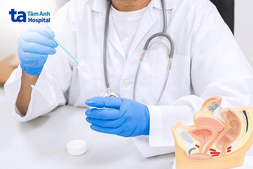 chọn địa chỉ khám tầm soát ung thư cổ tử cung uy tín