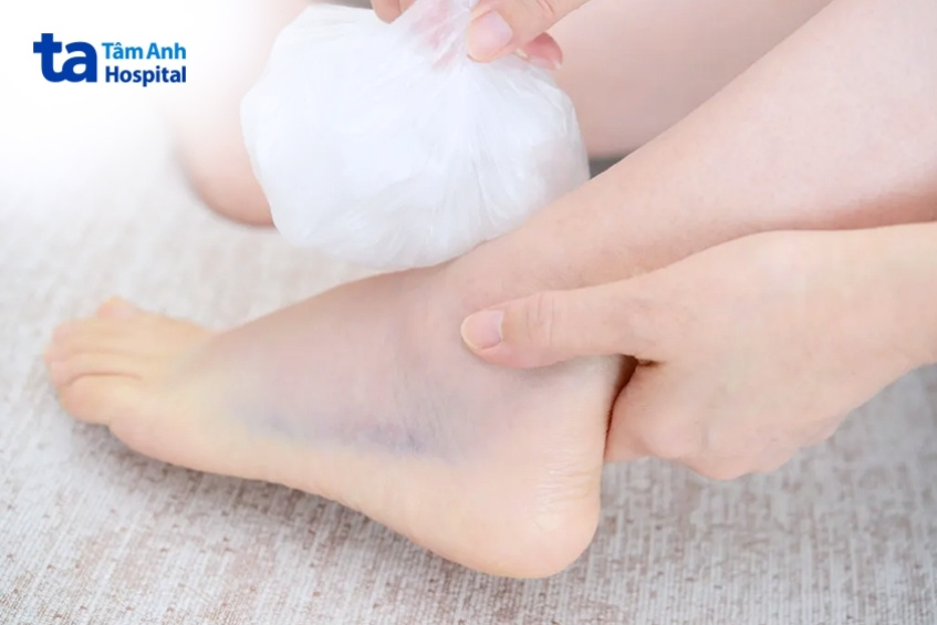 chườm đá giảm sưng