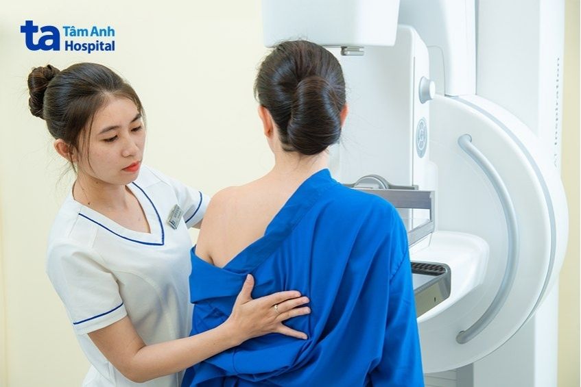 chụp nhũ ảnh