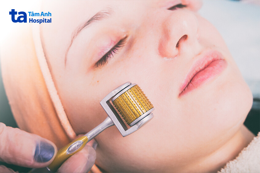 có thể kết hợp cả 2 phương pháp không