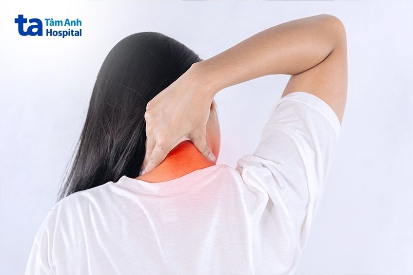 cứng cổ là dấu hiệu đau vai gáy