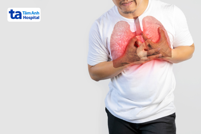 Nam bệnh nhân ôm ngực biểu hiện đau vùng phổi nghi ngờ khối u