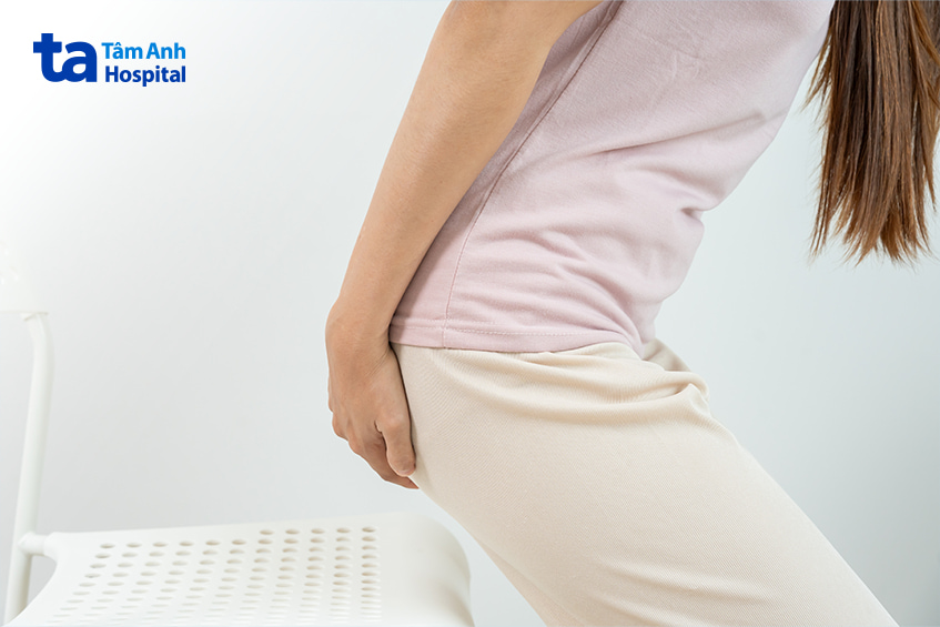 Phụ nữ đau rát hậu môn, biểu hiện thường gặp khi bị trĩ ngoại