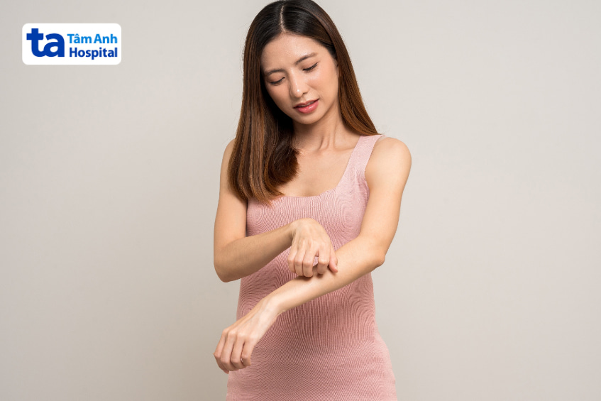 Phụ nữ đang gãi tay do dị ứng, biểu hiện thường gặp sau ăn hải sản