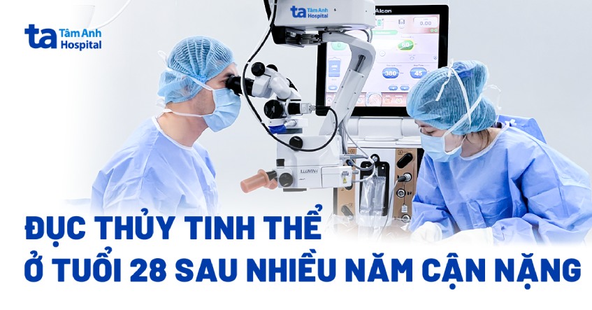 Đục thủy tinh thể ở tuổi 28 sau nhiều năm cận nặng
