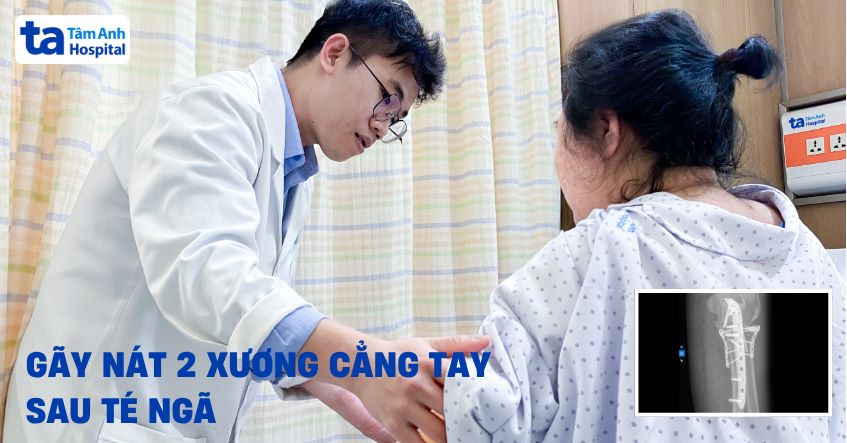 Gãy nát đầu trên 2 xương cẳng tay sau té ngã
