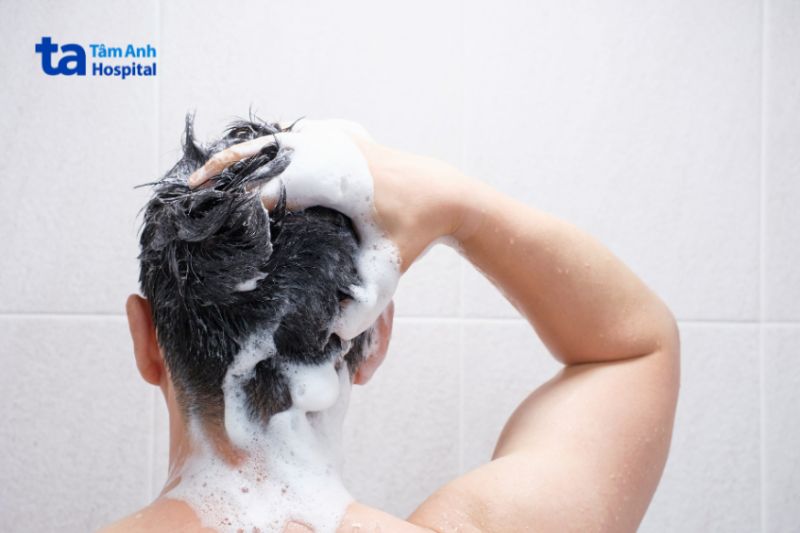 gọi đầu trị vảy nến trên da đầu