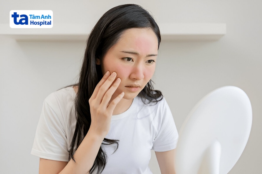hậu quả xông hơi sau tiêm filler