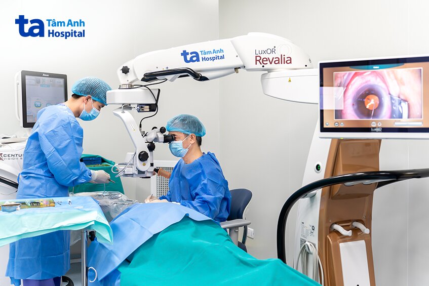 hệ thống điều trị đục thủy tinh thể