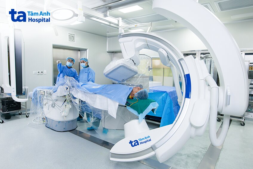 hệ thống dsa philips azurion flexarm