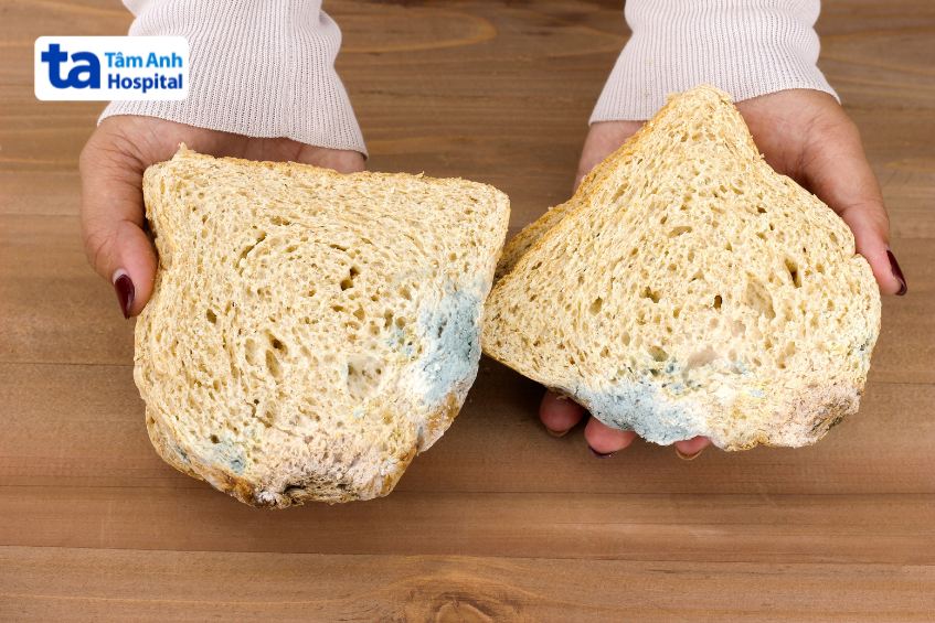 hình ảnh bị ngộ độc thực phẩm do ăn bánh mì mốc