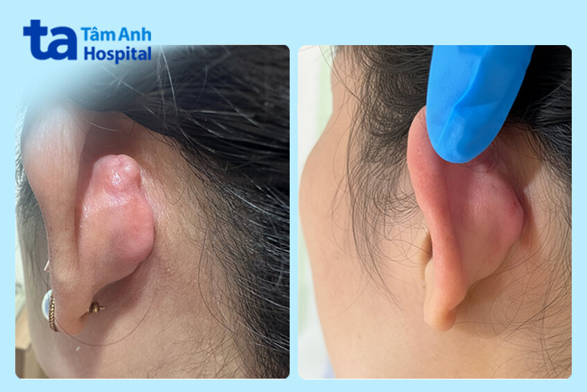 hình ảnh sau điều trị phục hồi