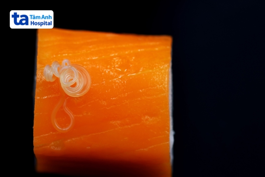 hình ngộ độc thực phẩm mô tả có giun ký sinh trong thịt cá sống