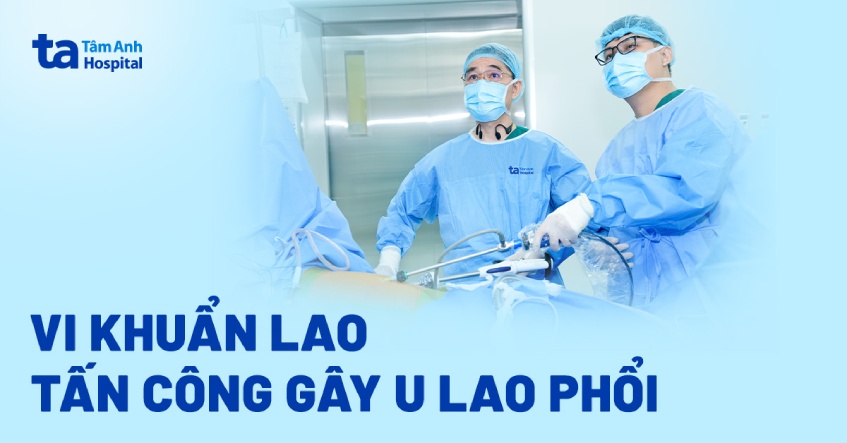 Ho kéo dài do u lao phổi