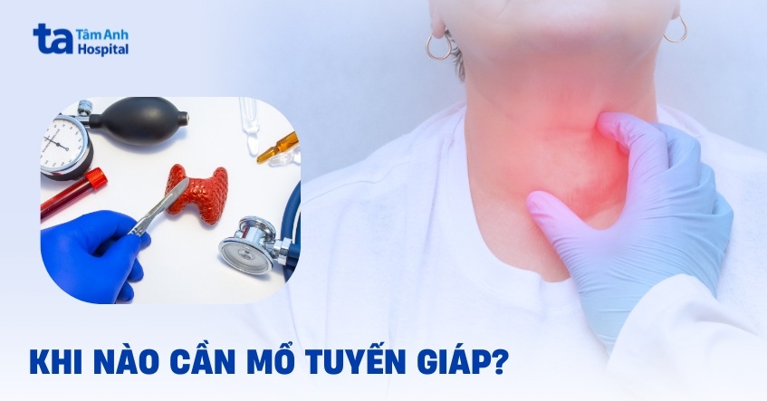 Khi nào cần mổ tuyến giáp? Nên lưu ý những gì?