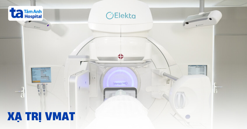 VMAT – Phương pháp xạ trị điều biến thể tích