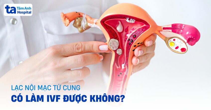 Lạc nội mạc tử cung có làm IVF được không? Khả năng chuyển phôi ra sao?