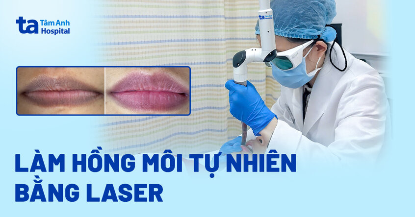 Môi thâm sạm lâu năm, người phụ nữ cải thiện rõ nhờ laser