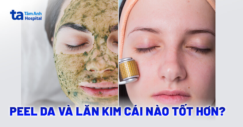Bảng so sánh chi tiết lăn kim và peel da: Cách lựa chọn đúng