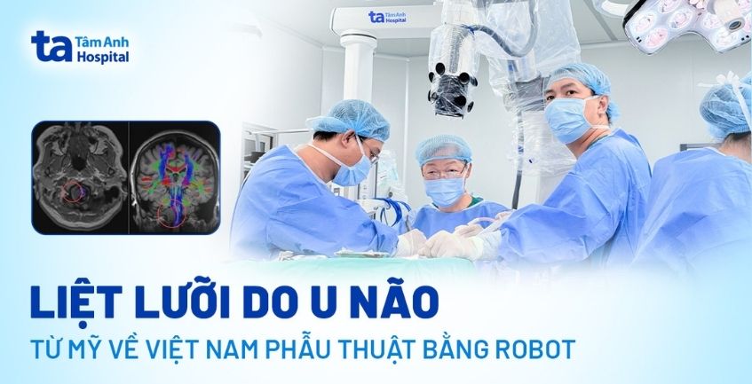 Liệt lưỡi do u não, từ Mỹ về Việt Nam phẫu thuật bằng robot