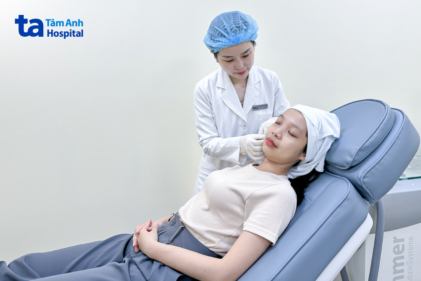 lưu ý khi rửa mặt sau tiêm filler