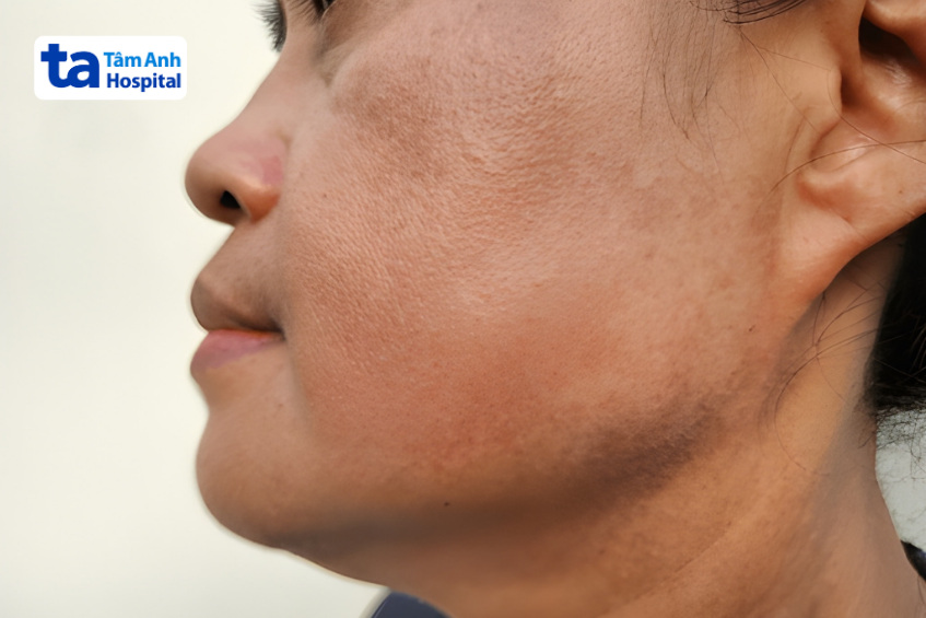 màu sắc da thay đổi là gì