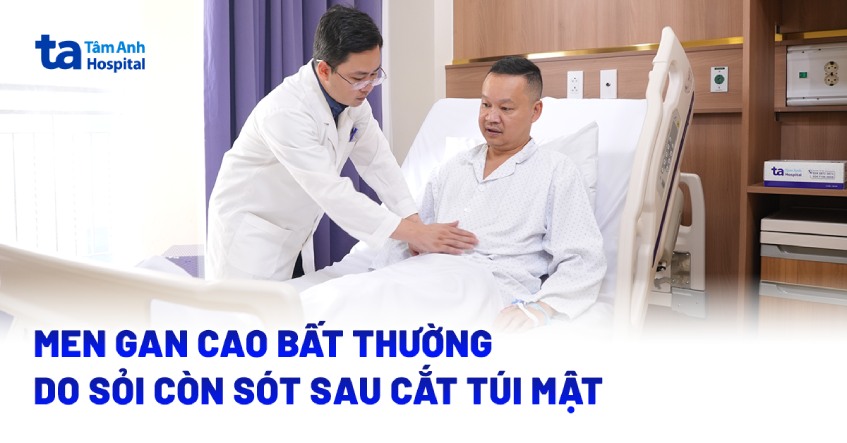 Men gan cao bất thường do sỏi còn sót sau cắt túi mật