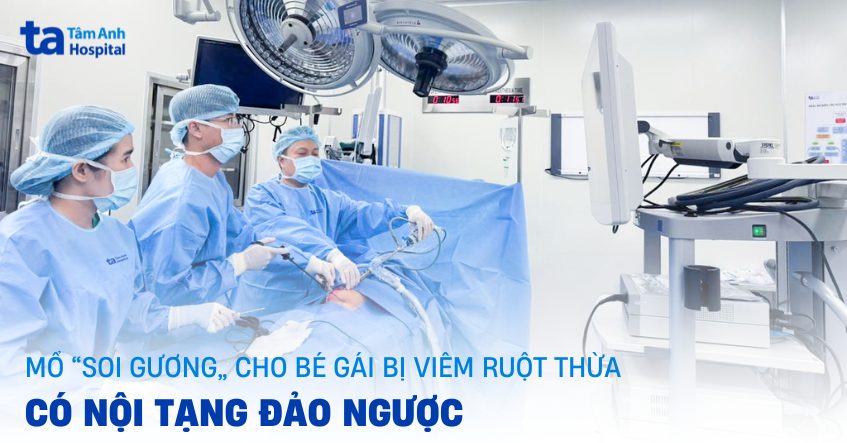Mổ “soi gương” cho bé gái bị viêm ruột thừa có nội tạng đảo ngược