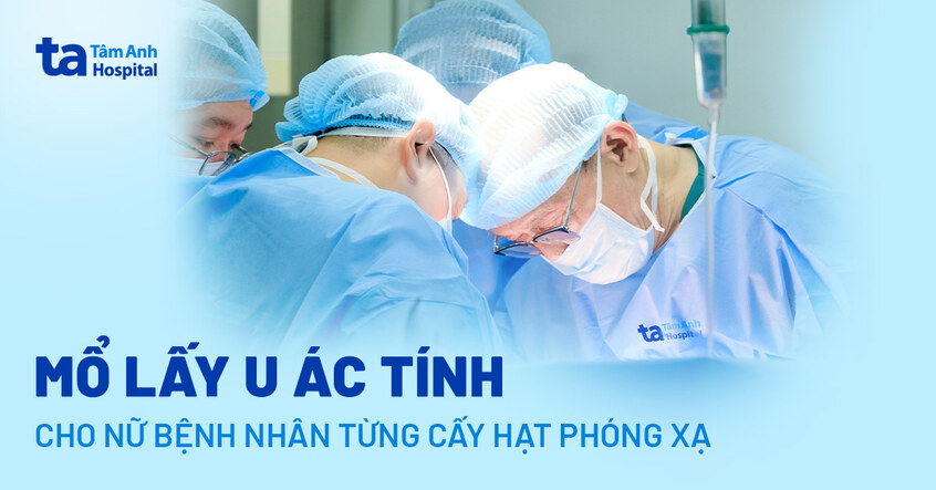 Mổ lấy u ác tính cho nữ bệnh nhân từng cấy hạt phóng xạ