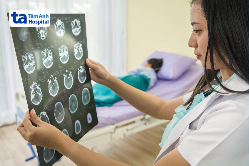 mức độ nghiêm trọng ảnh hưởng chi phí