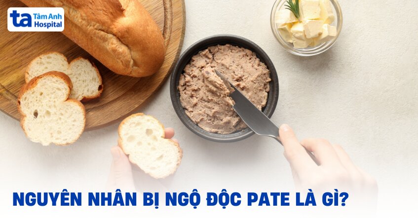 Nguyên nhân bị ngộ độc pate là gì? Nguy hiểm như thế nào?
