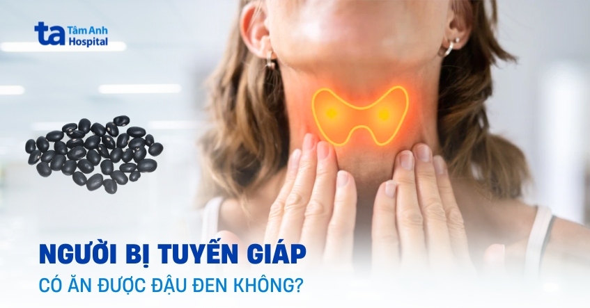 Người bị tuyến giáp có ăn được đậu đen không?