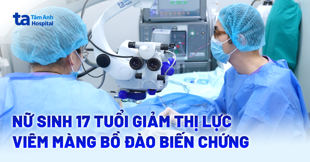 Nguy cơ mù lòa do biến chứng viêm màng bồ đào