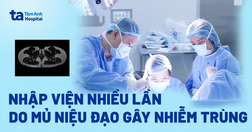 Nhập viện nhiều lần do mủ niệu đạo gây nhiễm trùng