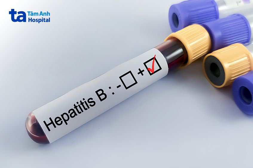 ống xét nghiệm máu viêm gan b