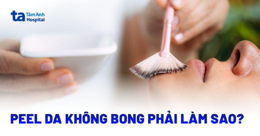 Tình trạng peel da không bong tróc phải làm sao?