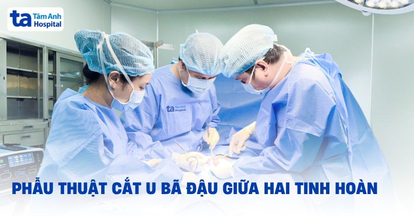 Khối u bã đậu ‘mọc’ giữa hai tinh hoàn