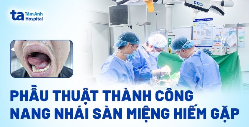 phẫu thuật nang nhái sàn miệng thành công