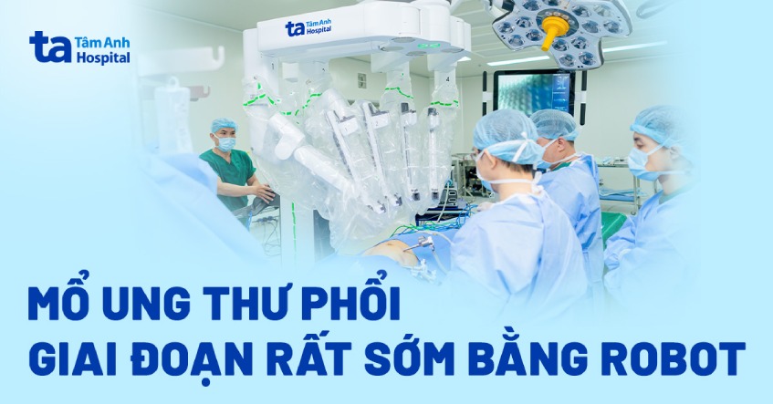 Robot mổ ung thư phổi giai đoạn rất sớm