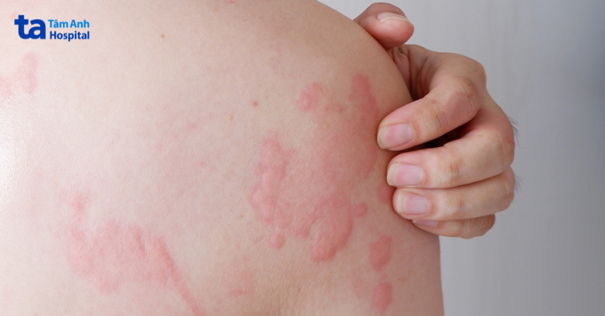 rủi ro nguy cơ có thể gặp