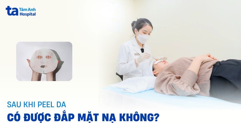 Sau khi peel da có nên đắp mặt nạ không?