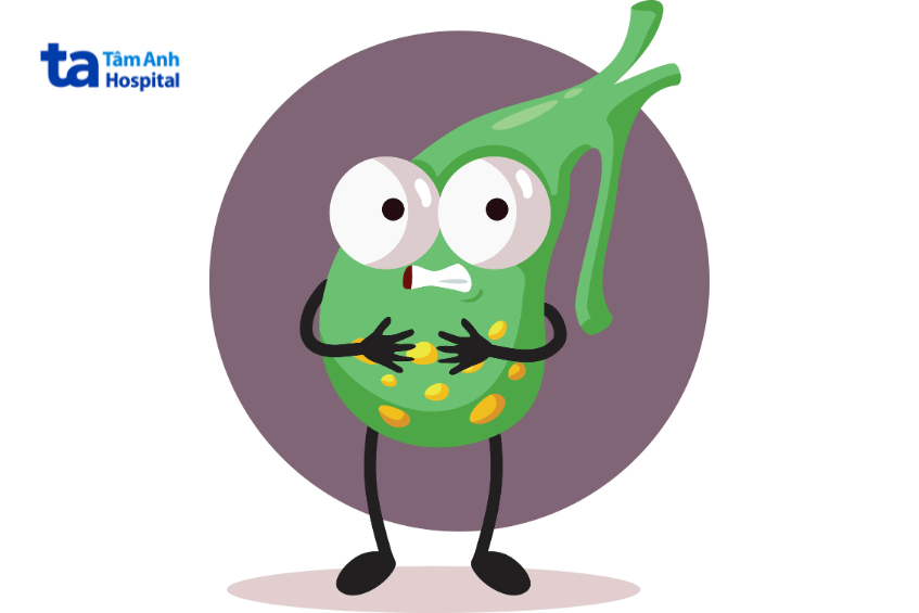 Hình minh họa túi mật bị sỏi cholesterol với biểu cảm đau đớn, nền tím, phong cách hoạt hình